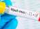 Nipha-Virus 2023-09-14
