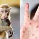 Monkey-Measles 2022 07 29