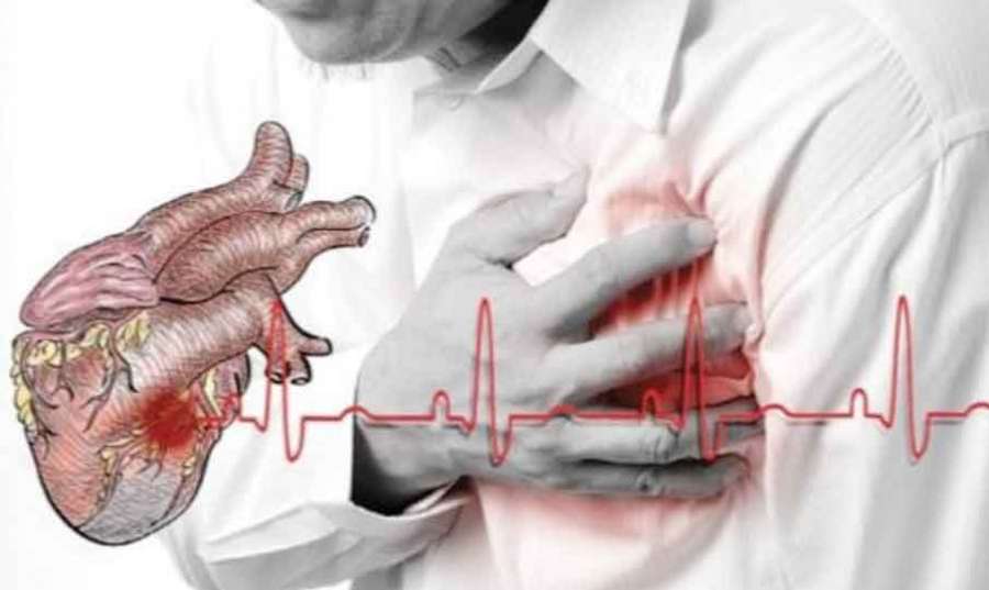 Heart-disease 2022 04 12