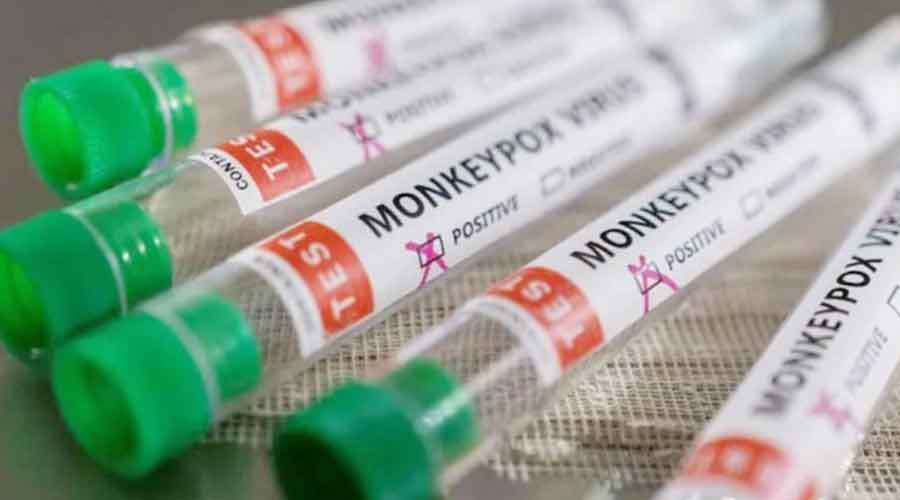 monkeypox-virus-----------22-07-22