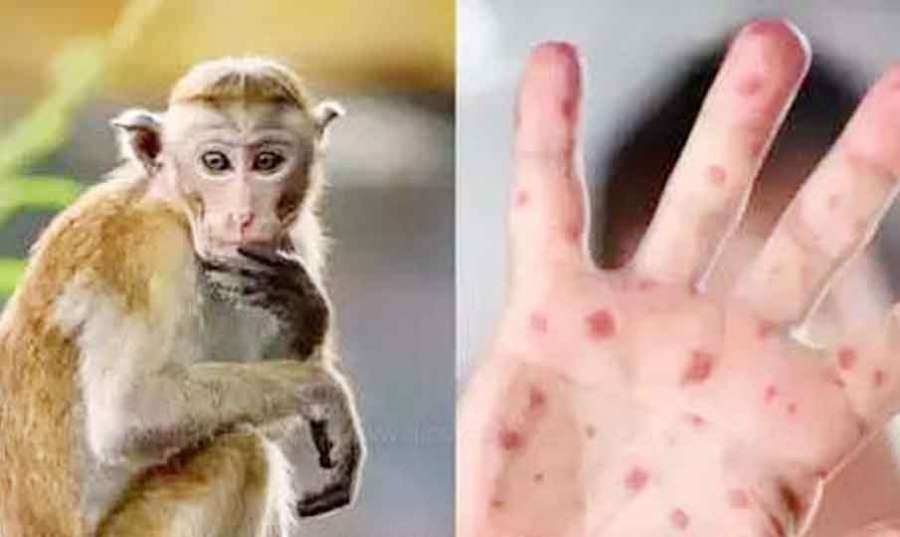 Monkey-Measles 2022 07 29