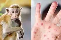 Monkey-Measles 2022 07 29